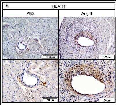 Thrombospondin-1 Antibody (A6.1) - Novus Biologicals