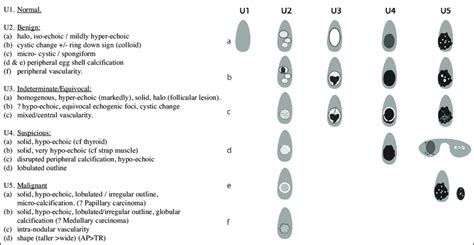 Thyroid Nodules with U Classification