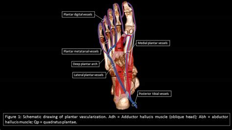 Tibial Artery - an overview ScienceDirect Topics