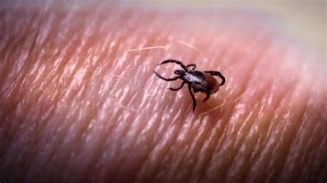 Tick Threat: What to know about tick season’s return to New England and the threat it poses