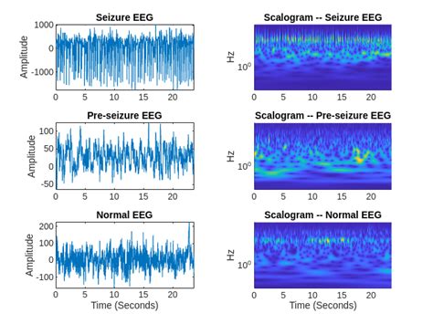 Time series eeg dataset. .  ...