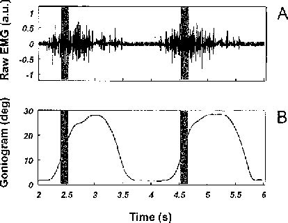 Time-frequency parameters of the surface myoelectric signal for ...