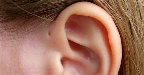 Tiny Lump in my Earlobe Ear Disorders and Hearing …