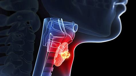 Tip Inadequate Sleep and Thyroid Function