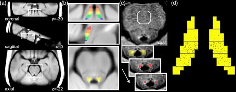 Tip The Neurological Contrast Method