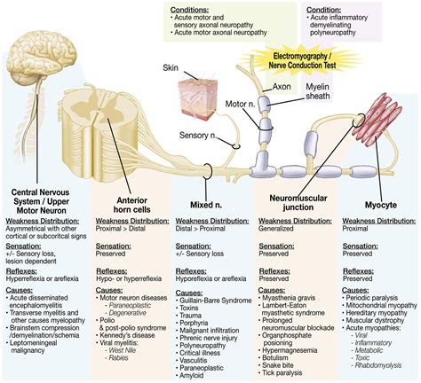 Tissue Collection Aids Search for Neurologic and Neuromuscular Disease Causes and Cures