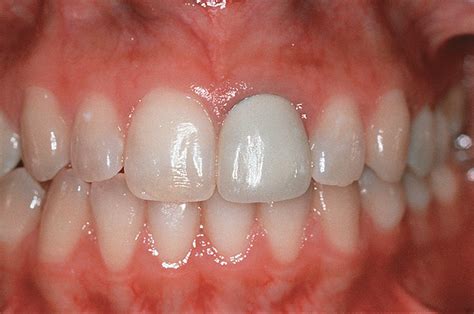 Tissue Management in Restorative Dentistry October 2007 FERD