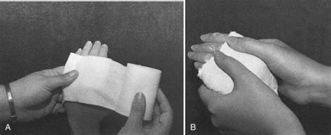 Tissue Remodeling and Contracture Correction Using Serial Plaster ...