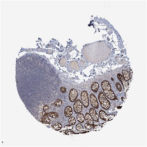 Tissue expression of KRAS - Staining in lymph node - The Human …