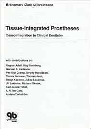 Download Tissue Integrated Prostheses By Branemark