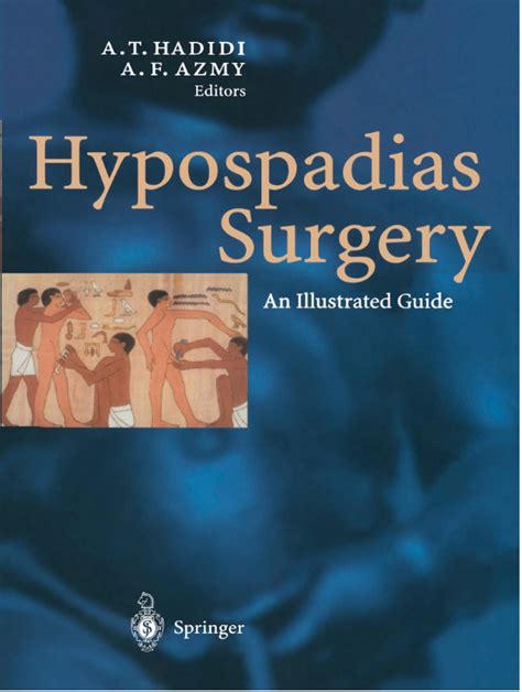 Title hypospadias surgery an illustrated guide. - Elder scrolls iv oblivion guida al gioco.