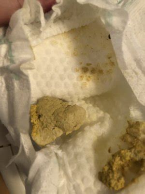 Toddler poop help! Pale yellow/beige poop BabyCenter