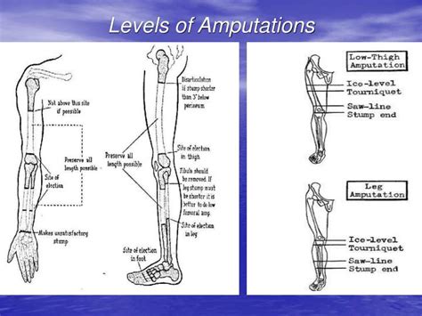 Toe Amputation/ Loss of Use Diagram - Ohio