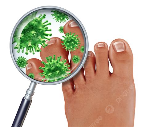 Toe Fungus PNG Images With Transparent Background Free …