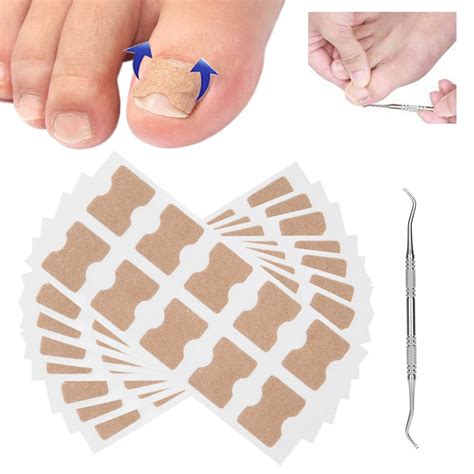 Toe Nail Treatment Patch Ingrown Toenail Correction Stickers