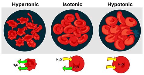 Tonicity - Wikipedia