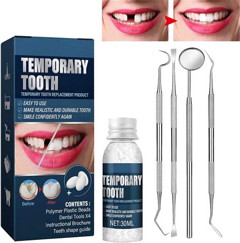 Tooth Repair Kit: Best Temporary Filling Options in the US