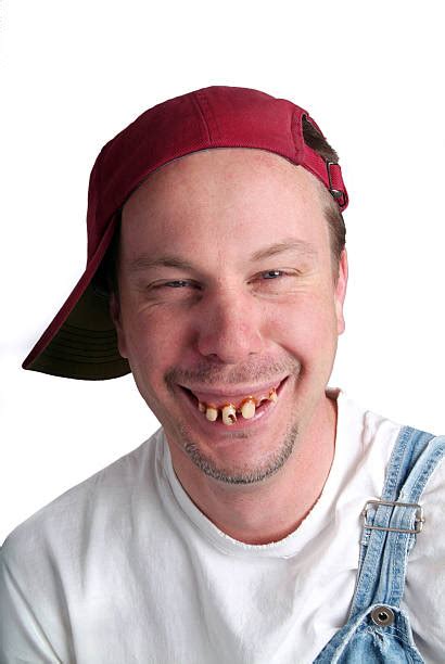 Toothless hillbilly photos. 676 Funny Toothless Stock Photos & High-Res Pictures. Browse 676 funny toothless photos and images available, or start a new search to explore more photos and images. happy man with black eye and missing teeth - funny toothless stock pictures, royalty-free photos & images. 
