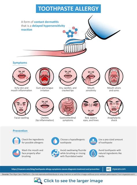 Toothpaste Allergy: Causes & Symptoms (2025)