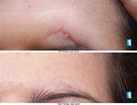 Top 10 Best Scar Revision in Fairfax, VA - November 2024 - Yelp