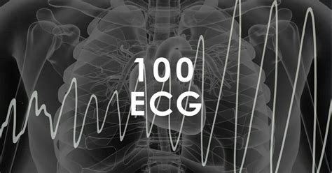 Top 100 Clinical Cases • LITFL • CXR • ECG • Cases