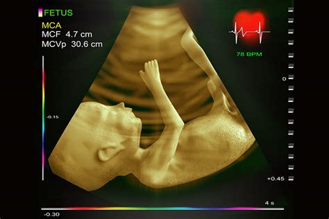 Top specialists for fetal echocardiogram in Kent TopDoctors