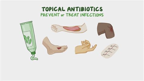 Topical antibiotics for skin infection otc.  Learn about effective tre...