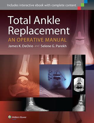 Total ankle replacement an operative manual by james k deorio. - Evaluation in practice a methodological approach 2nd edition.