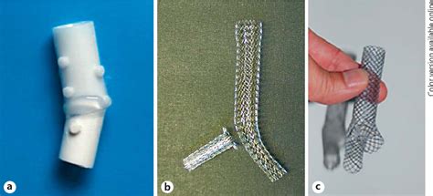 Tracheobronchial Silicone Stents - Alya Advancement