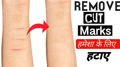 Translate cut mark of left cheek in Hindi with examples