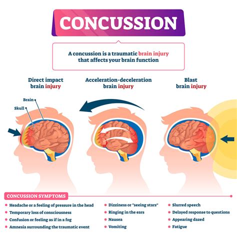 Traumatic Brain Injury / Concussion Concussion Traumatic …