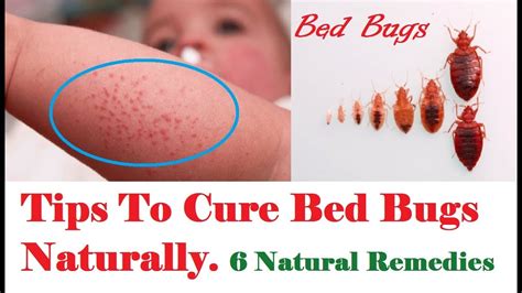 Treat bed bugs. Things To Know About Treat bed bugs. 