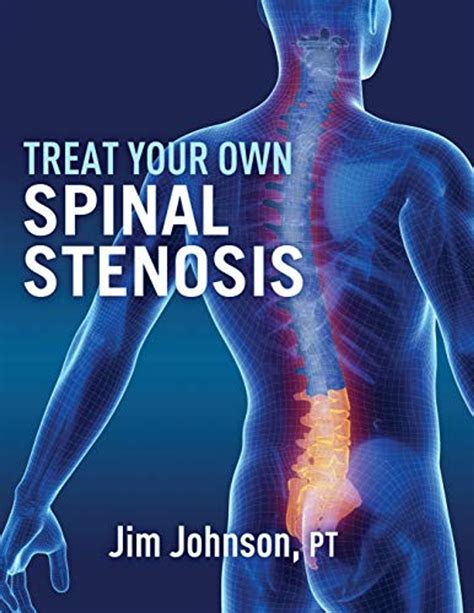Read Online Treat Your Own Spinal Stenosis By Jim  Johnson