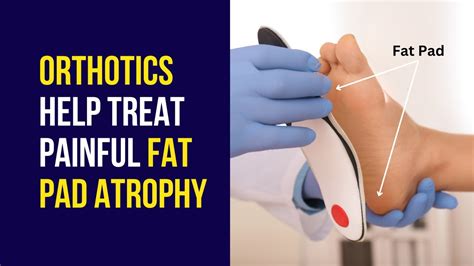 Treating Fat Pad Atrophy