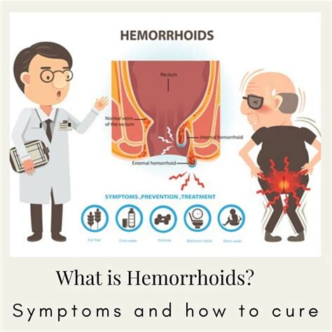 Treatment for Hemorrhoids by Dr. Tsan - Philadelphia Holistic …