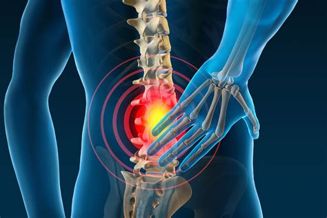 Treatment for pain from sciatica, cancer research journal in india ...