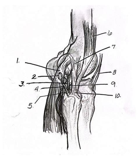 Treatment of Fabella Syndrome with Manual Therapy: …