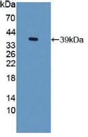 Trefoil Factor 3多肽 Abcam中文官网