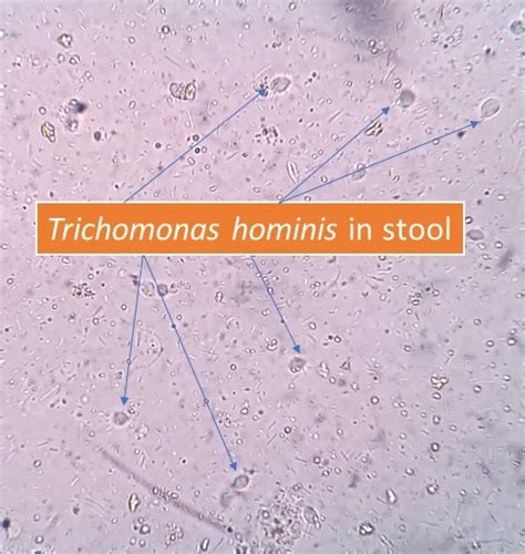 Trichomonas hominis: Introduction, morphology, Lab …