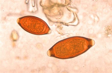 Trichuris trichiura Medical Laboratories