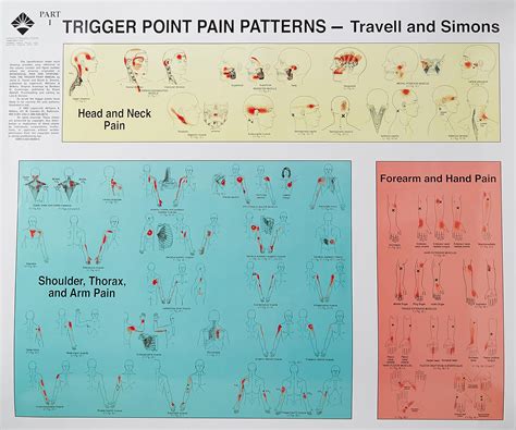 Trigger Point Pain Patterns Wall Charts