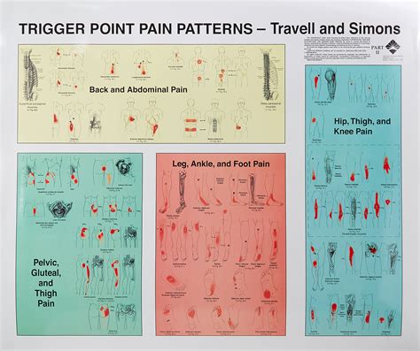 Read Trigger Point Pain Patterns Wall Charts By Janet Travell