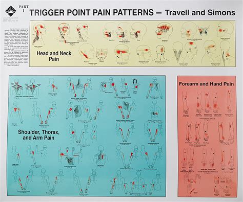 Read Trigger Point Pain Patterns Wall Charts By Janet Travell
