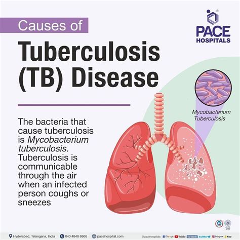 Tuberculosis how it is caused