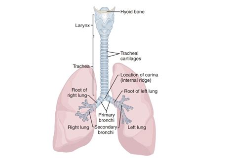 Tuberculosis of the upper respiratory tract, trachea and …