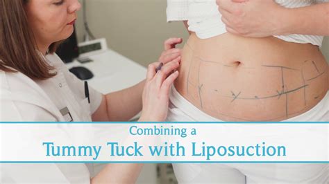 Tightening Up the Abs with a Tummy Tuck - Tannan Plastic Surgery