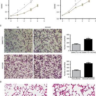 Tumor repressor gene chondroadherin oppose migration and …