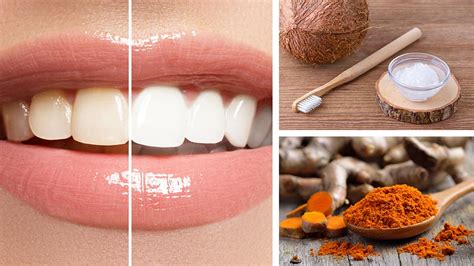 Turmeric Teeth Whitening, Coconut Oil, Snopes, Myth, Recipe, …