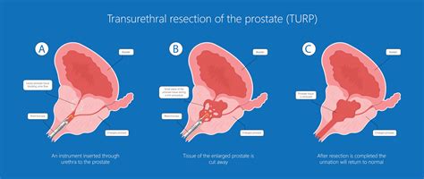 Turp Halı ve Koltuk Yıkama