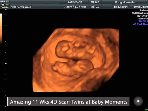 Twins 3D Scan: Latest Twins News Minnesota Twins image 1